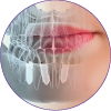 implantología dental