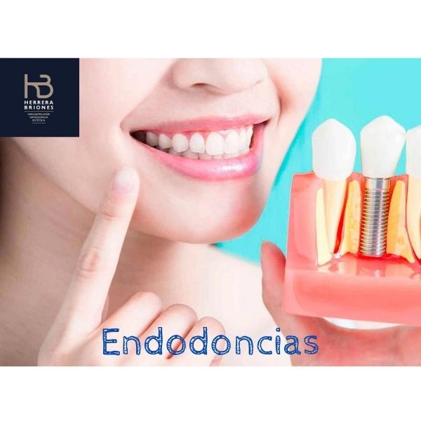 tratamiento de endodoncia