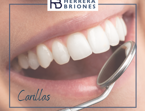 CARILLAS DENTALES ¿MEJORAN TU IMAGEN?